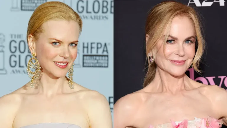 Nicole kidman plastic surgery